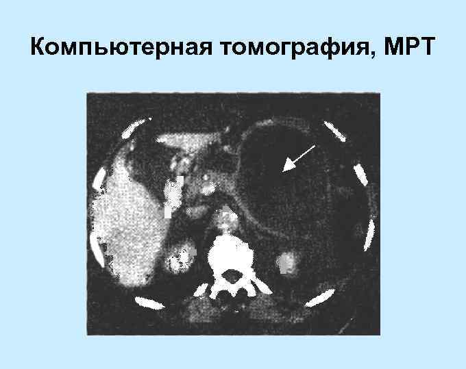 Компьютерная томография, МРТ 