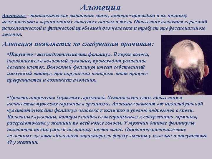Алопеция – патологическое выпадение волос, которое приводит к их полному исчезновению в ограниченных областях