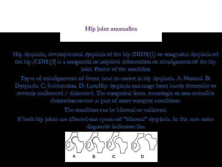 Hip joint anomalies Hip dysplasia, developmental dysplasia of the hip (DDH)[1] or congenital dysplasia