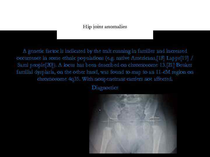 Hip joint anomalies A genetic factor is indicated by the trait running in families