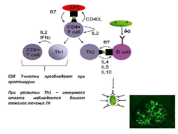 СD 8 T-клетки протеинурии преобладают при При развитии Th 1 – иммунного ответа ?