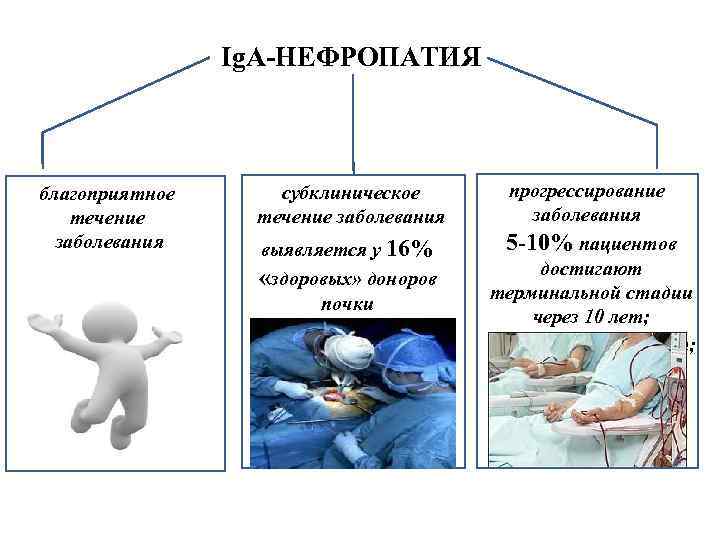 Ig. A-НЕФРОПАТИЯ благоприятное течение заболевания субклиническое течение заболевания выявляется у 16% «здоровых» доноров почки