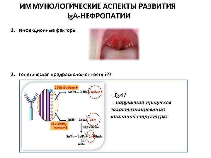 ИММУНОЛОГИЧЕСКИЕ АСПЕКТЫ РАЗВИТИЯ Ig. A-НЕФРОПАТИИ 1. Инфекционные факторы 2. Генетическая предрасположенность ? ? ?