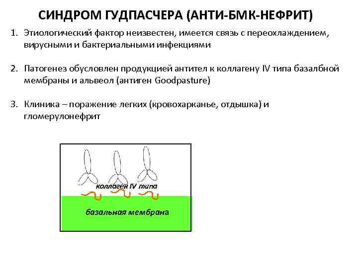 СИНДРОМ ГУДПАСЧЕРА (АНТИ-БМК-НЕФРИТ) 1. Этиологический фактор неизвестен, имеется связь с переохлаждением, вирусными и бактериальными