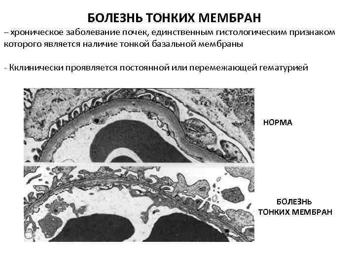 Слои базальной мембраны