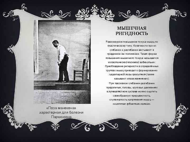 МЫШЕЧНАЯ РИГИДНОСТЬ Равномерное повышение тонуса мышц по пластическому типу. Конечности при их сгибании и