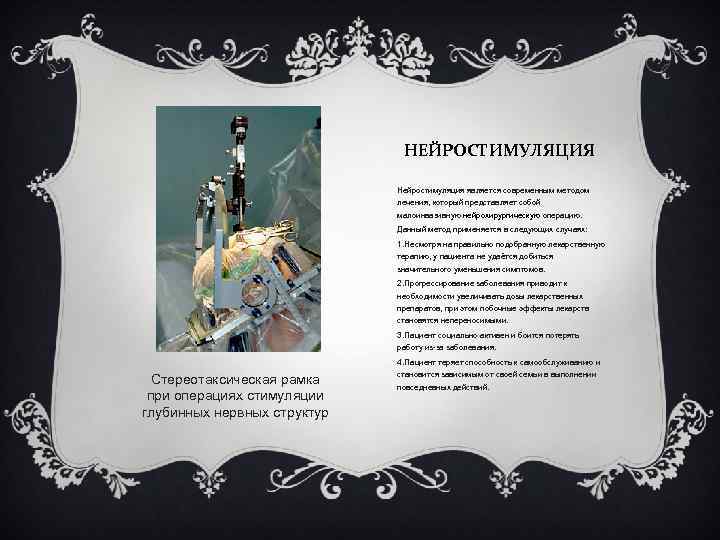 НЕЙРОСТИМУЛЯЦИЯ Нейростимуляция является современным методом лечения, который представляет собой малоинвазивную нейрохирургическую операцию. Данный метод
