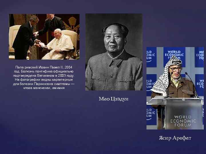 Папа римский Иоанн Павел II, 2004 год. Болезнь понтифика официально подтверждена Ватиканом в 2003