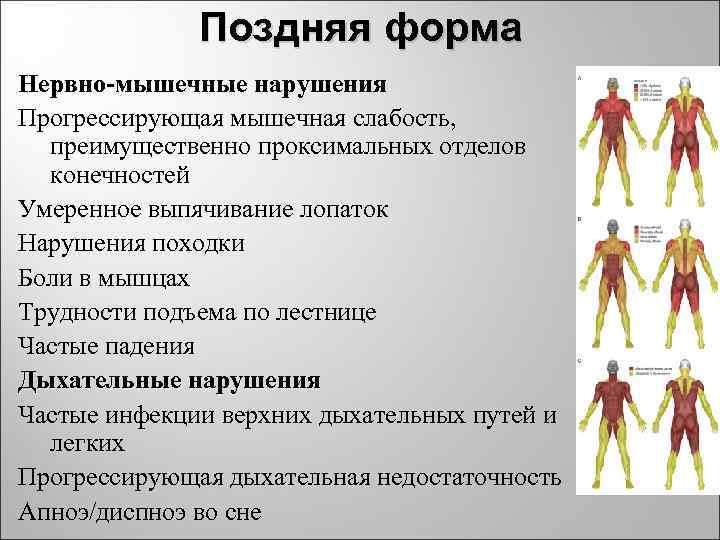 Поздняя форма Нервно-мышечные нарушения Прогрессирующая мышечная слабость, преимущественно проксимальных отделов конечностей Умеренное выпячивание лопаток