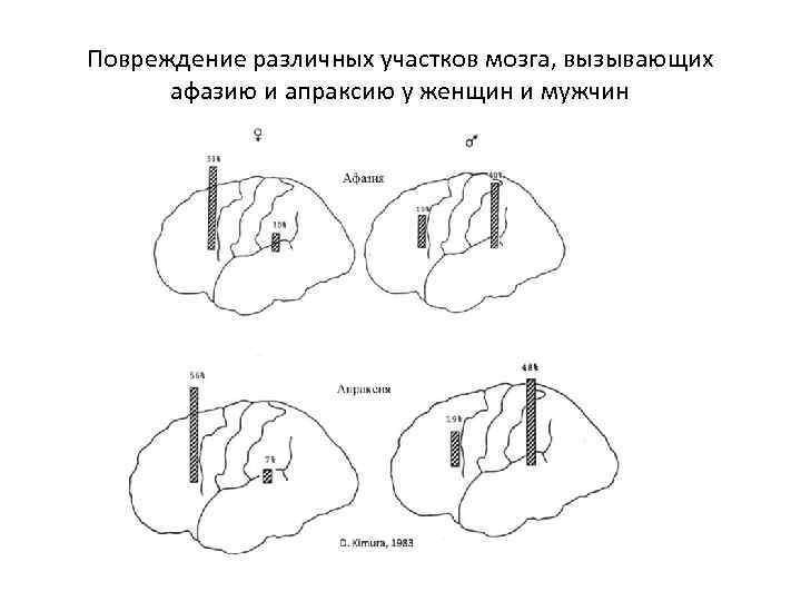 Повреждение различных участков мозга, вызывающих афазию и апраксию у женщин и мужчин 