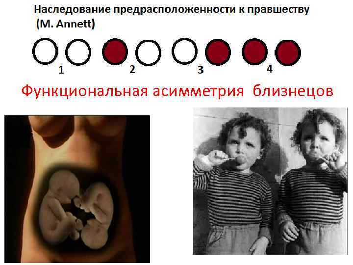 Функциональная асимметрия близнецов 