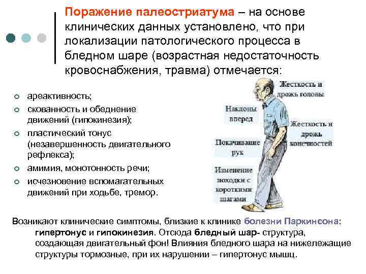 Поражение палеостриатума – на основе клинических данных установлено, что при локализации патологического процесса в