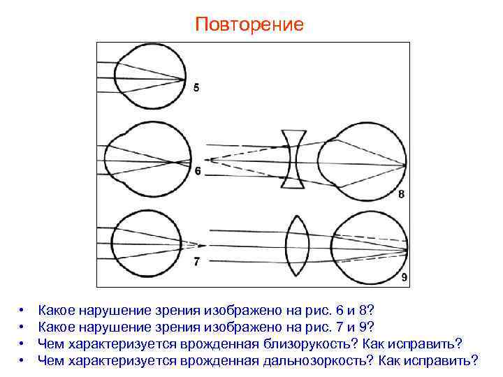 Повторение • • Какое нарушение зрения изображено на рис. 6 и 8? Какое нарушение