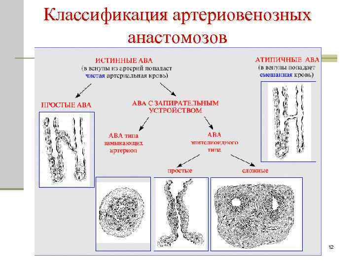 Классификация артериовенозных анастомозов 12 