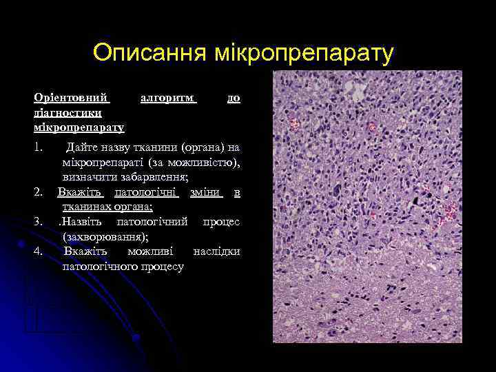 Описання мікропрепарату Оріентовний діагностики мікропрепарату 1. 2. 3. 4. алгоритм до Дайте назву тканини