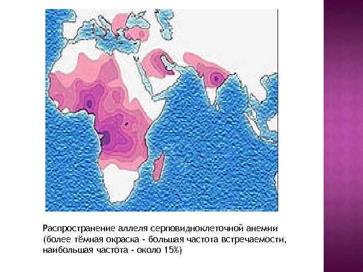 Распространение аллеля серповидноклеточной анемии (более тёмная окраска - большая частота встречаемости, наибольшая частота -