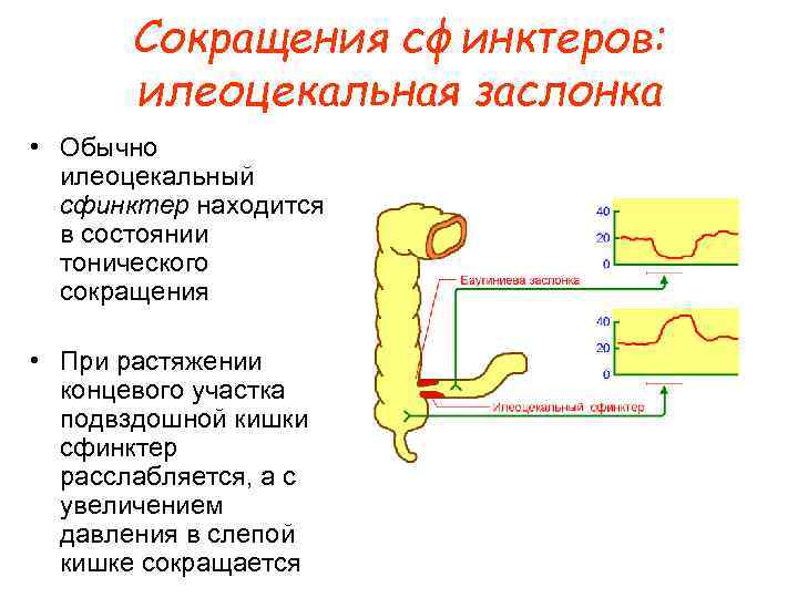 Сокращения сфинктеров: илеоцекальная заслонка • Обычно илеоцекальный сфинктер находится в состоянии тонического сокращения •