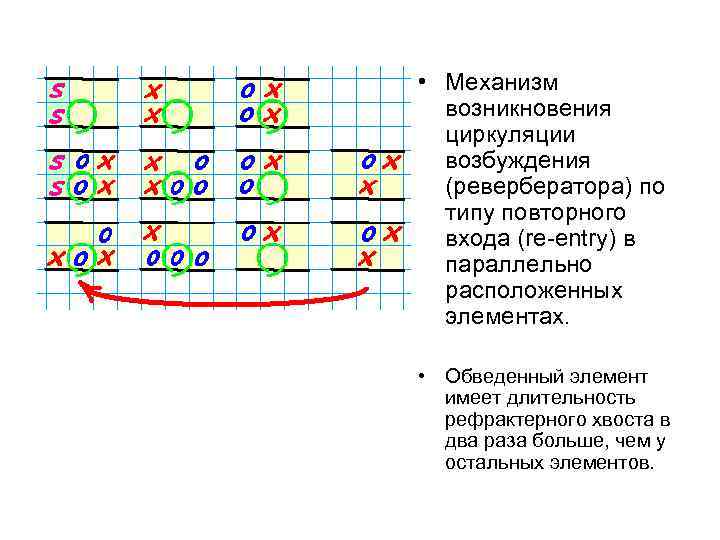  • Механизм возникновения циркуляции возбуждения (ревербератора) по типу повторного входа (re-entry) в параллельно