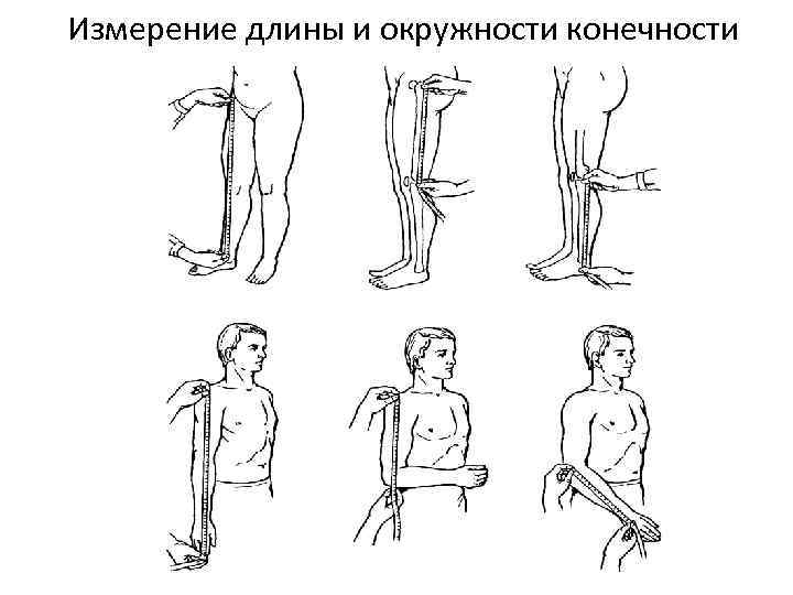 Нижний измерение. Измерение длины верхней конечности травматология. Измерение длины нижней конечности травматология. Измерение функциональной длины конечностей. Измерение длины конечностей в травматологии.