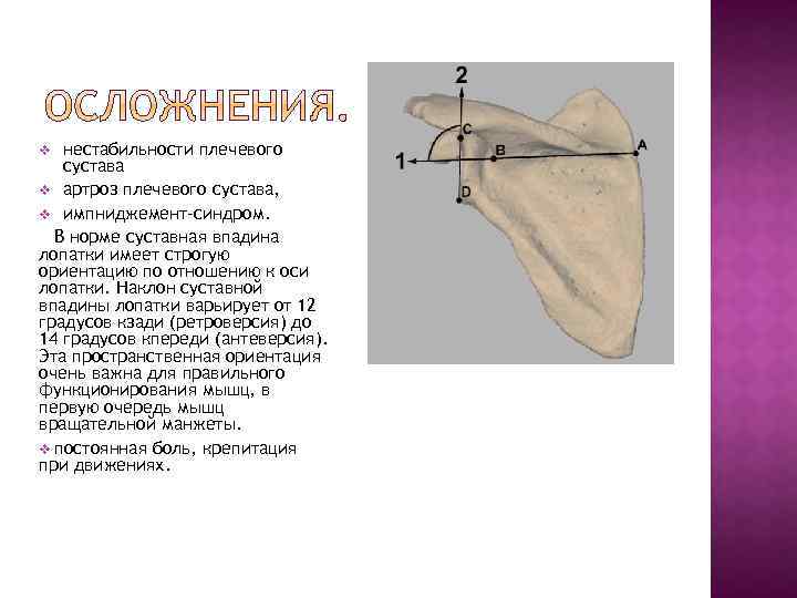 нестабильности плечевого сустава v артроз плечевого сустава, v импниджемент-синдром. В норме суставная впадина лопатки