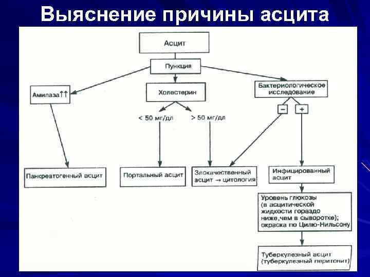 Выяснение причины асцита 
