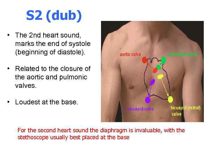 S 2 (dub) • The 2 nd heart sound, marks the end of systole