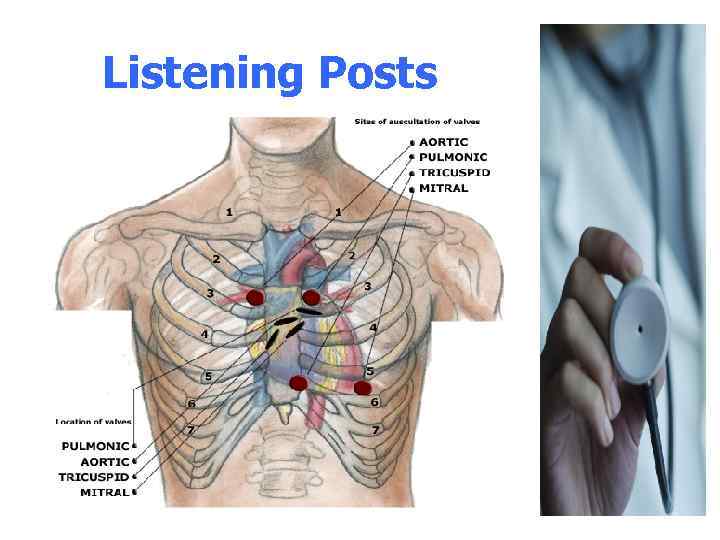Heart Sounds Murmurs The Stethoscope