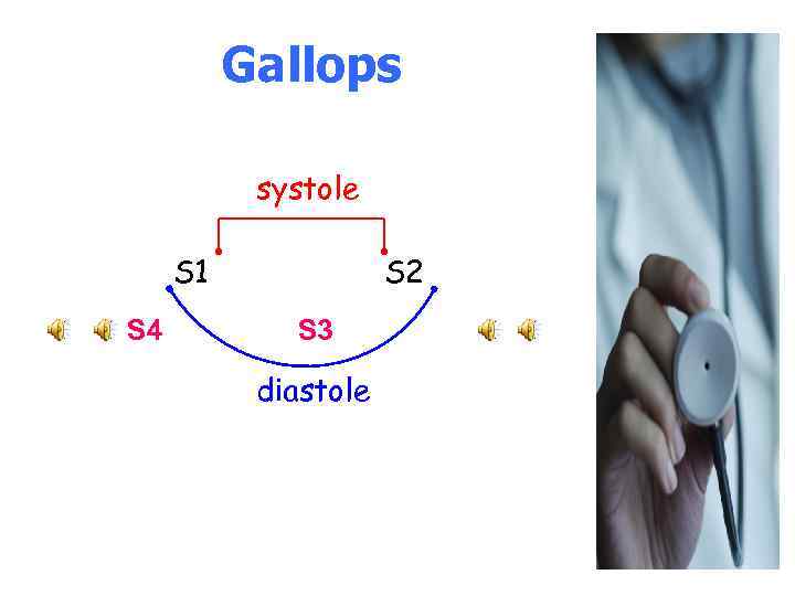 Gallops systole S 1 S 4 S 2 S 3 diastole 