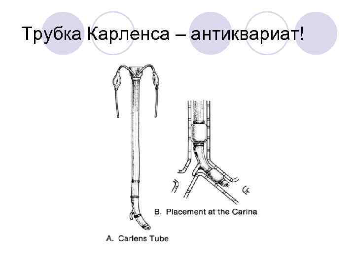 Трубка Карленса – антиквариат! 