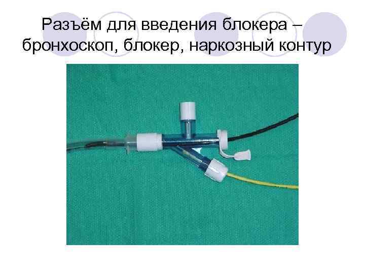 Разъём для введения блокера – бронхоскоп, блокер, наркозный контур 