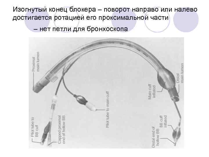 Изогнутый конец блокера – поворот направо или налево достигается ротацией его проксимальной части –