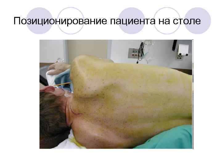 Позиционирование пациента на столе 