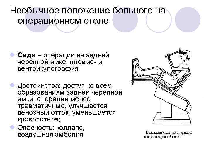 Необычное положение больного на операционном столе l Сидя – операции на задней черепной ямке,