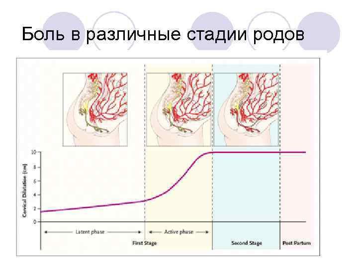 Боль в различные стадии родов 
