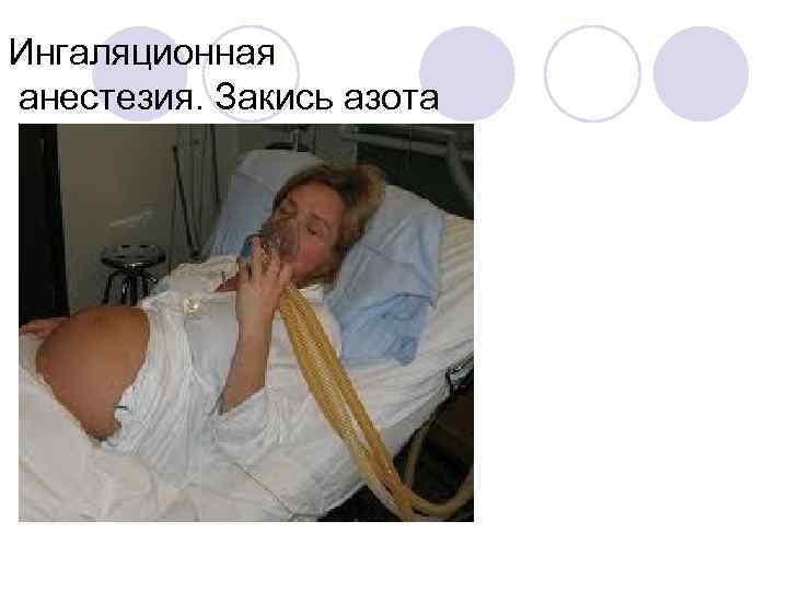 Ингаляционная анестезия. Закись азота 