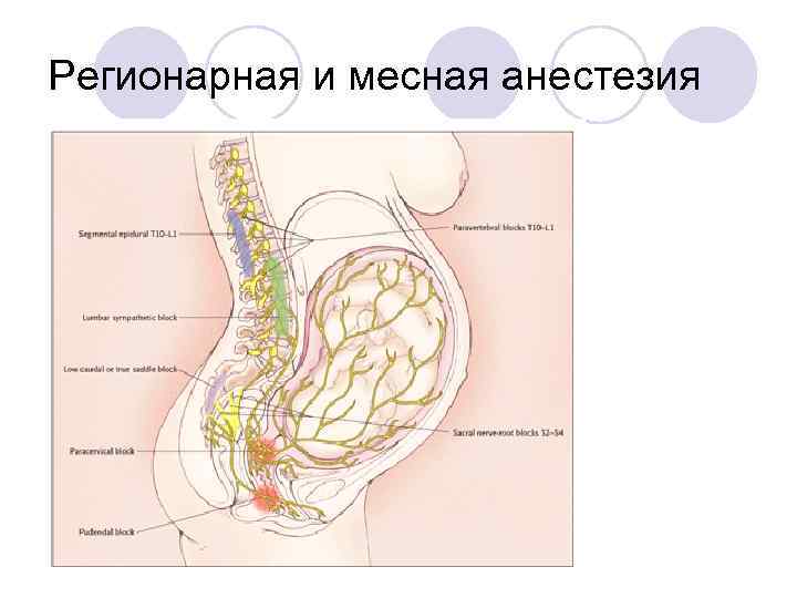Регионарная и месная анестезия 