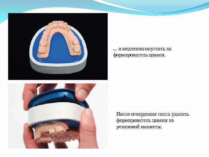 . . . и медленно опустить на формирователь цоколя. После отвердения гипса удалить формирователь
