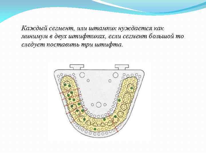 Каждый сегмент, или штампик нуждается как минимум в двух штифтиках, если сегмент большой то