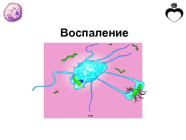 Воспаление 