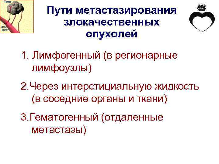 Пути метастазирования злокачественных опухолей 1. Лимфогенный (в регионарные лимфоузлы) 2. Через интерстициальную жидкость (в