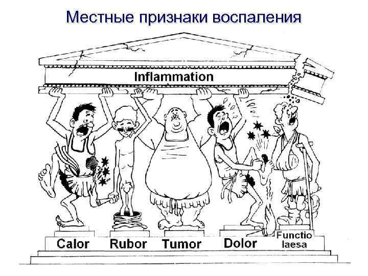 Местные признаки воспаления 