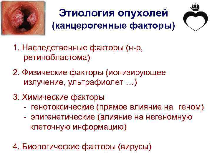 Этиология опухолей (канцерогенные факторы) 1. Наследственные факторы (н-р, ретинобластома) 2. Физические факторы (ионизирующее излучение,