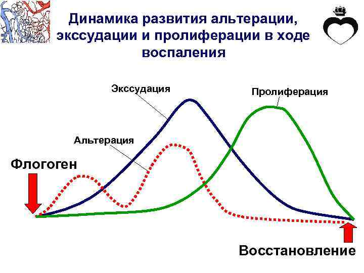 Динамика развития альтерации, экссудации и пролиферации в ходе воспаления Экссудация Пролиферация Альтерация Флогоген Восстановление