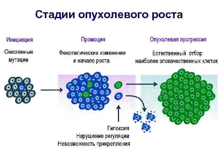 Стадии опухолевого роста 
