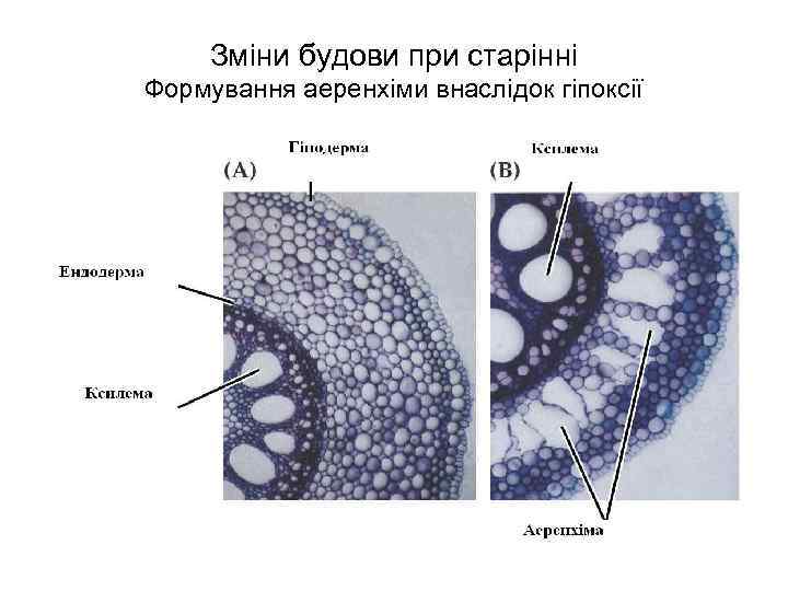 Зміни будови при старінні Формування аеренхіми внаслідок гіпоксії 