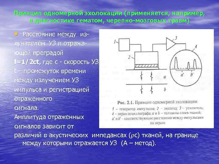 Принцип одномерной эхолокации (применяется, например, в диагностике гематом, черепно-мозговых травм) • Расстояние между излучателем