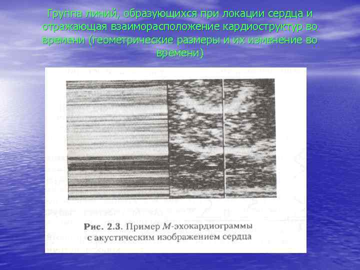 Группа линий, образующихся при локации сердца и отражающая взаиморасположение кардиоструктур во времени (геометрические размеры