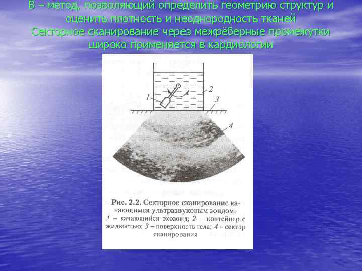 В – метод, позволяющий определить геометрию структур и оценить плотность и неоднородность тканей Секторное