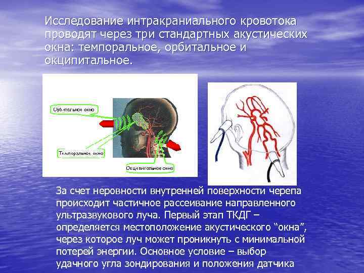 Исследование интракраниального кровотока проводят через три стандартных акустических окна: темпоральное, орбитальное и окципитальное. За