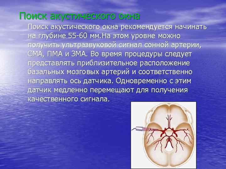 Поиск акустического окна рекомендуется начинать на глубине 55 -60 мм. На этом уровне можно